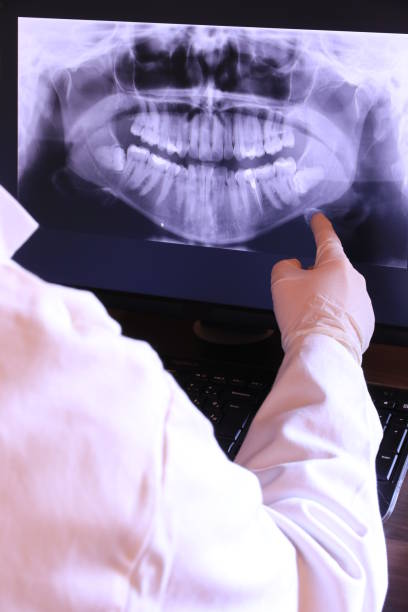 Best Emergency Tooth Extraction in Anderson, SC