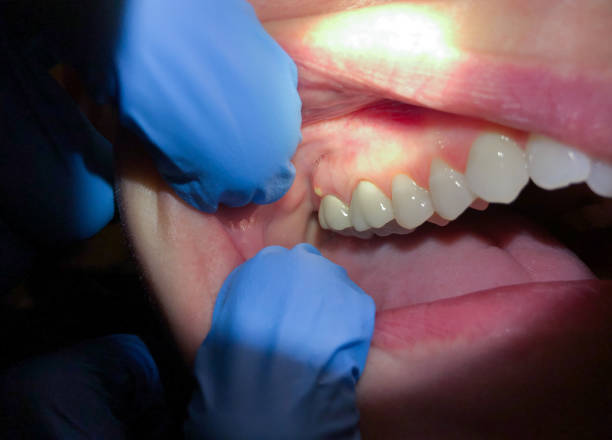 Best Walk-In Emergency Dentist in Anderson, SC